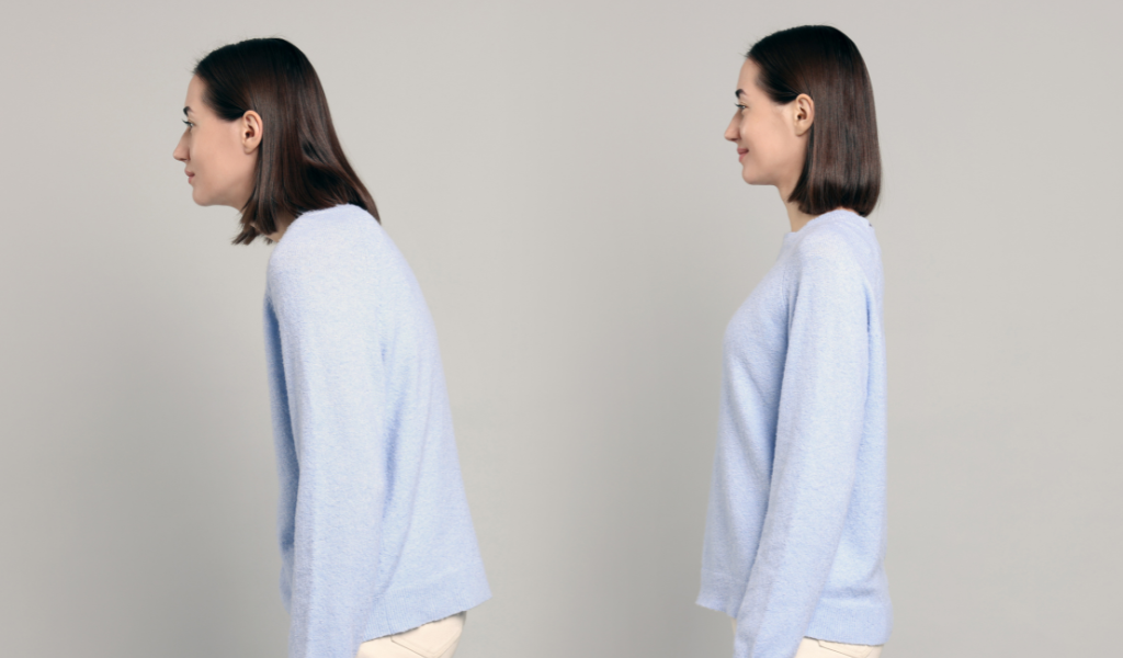 Poor posture treatment in san antonio